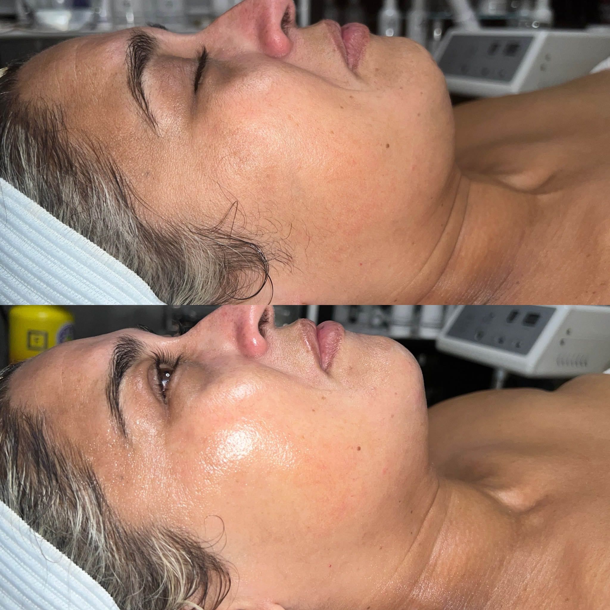 Melissa in her treatment room