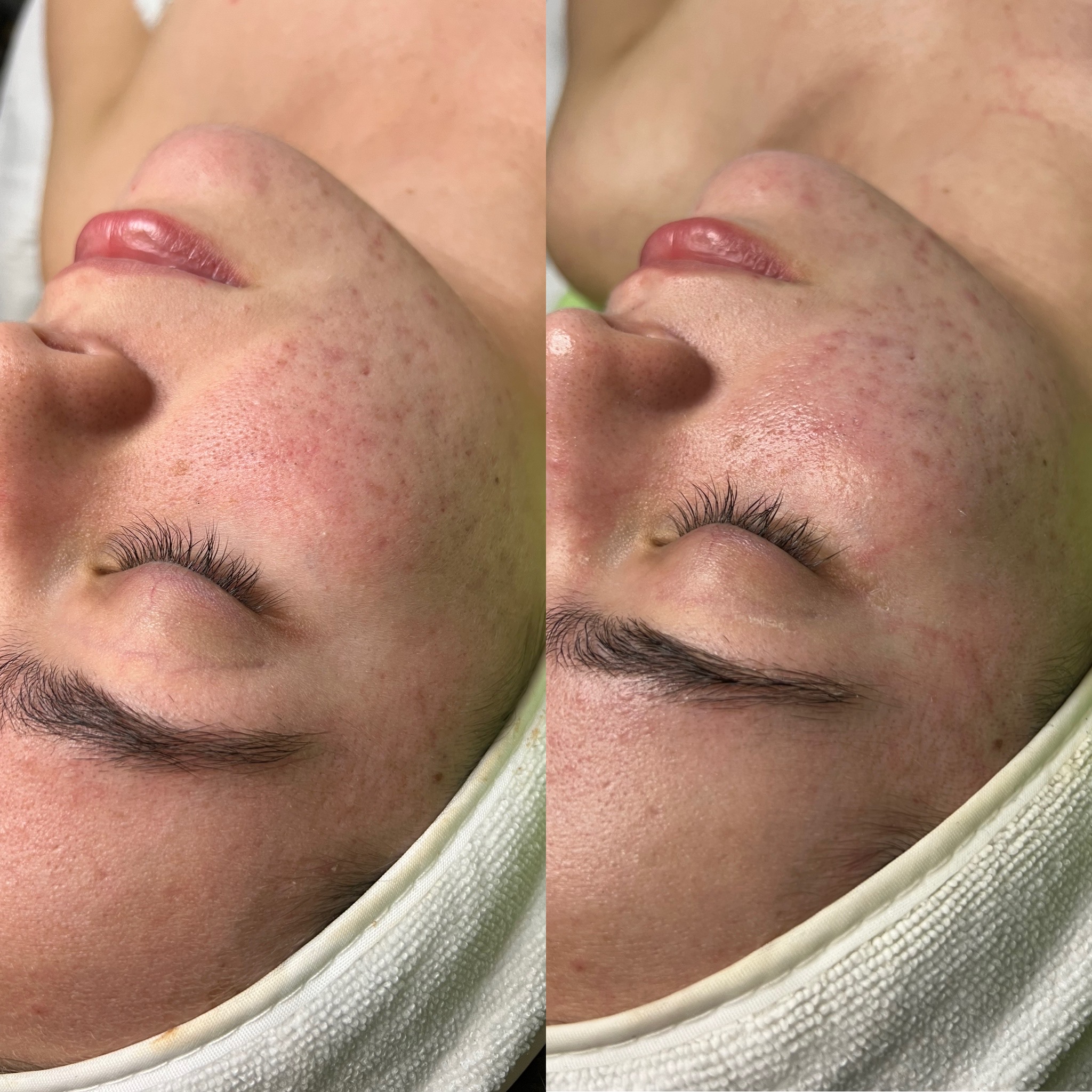 Home care skincare routine