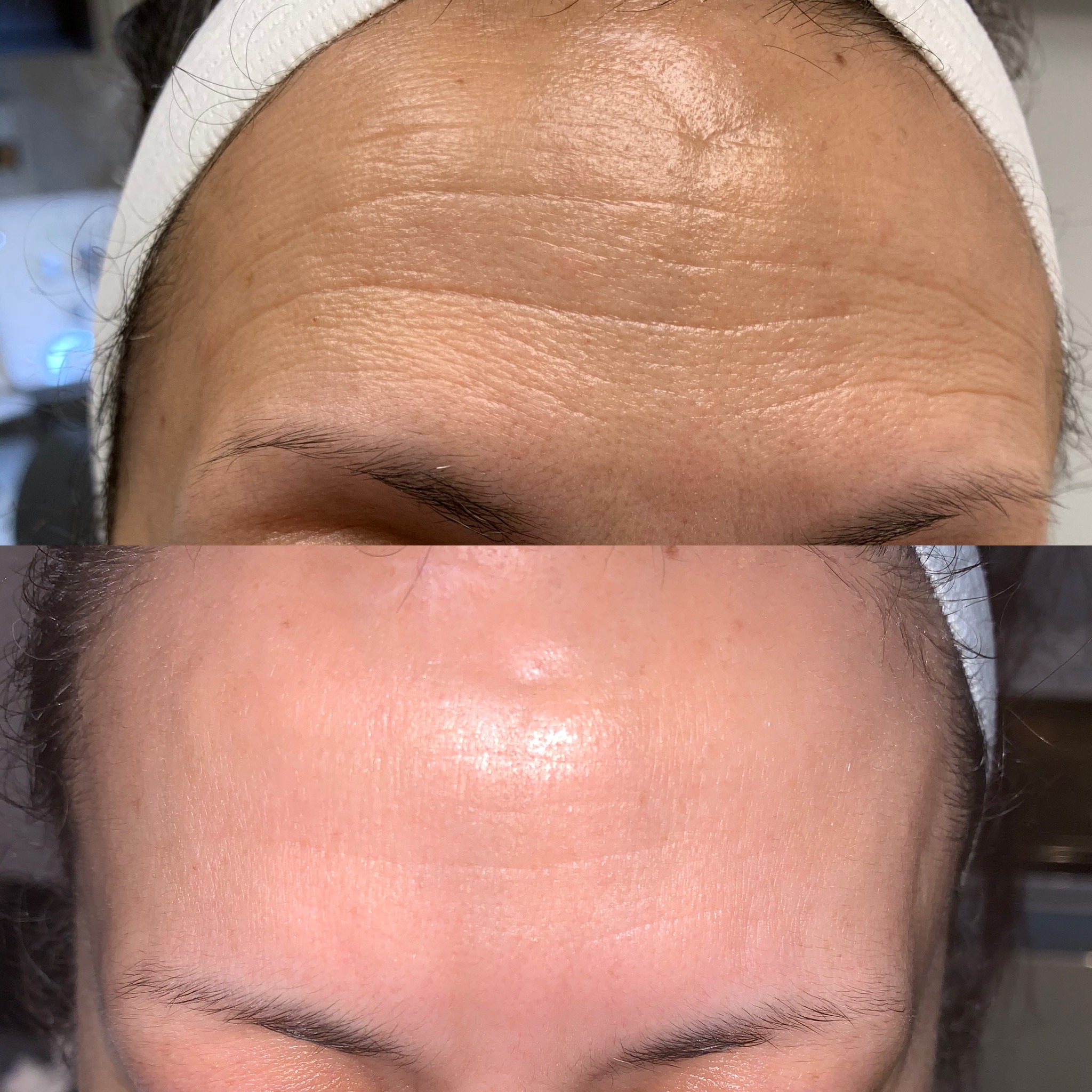 Skin transformation