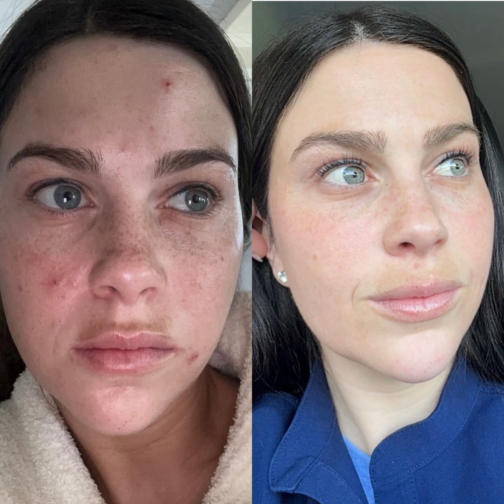 Skin transformation